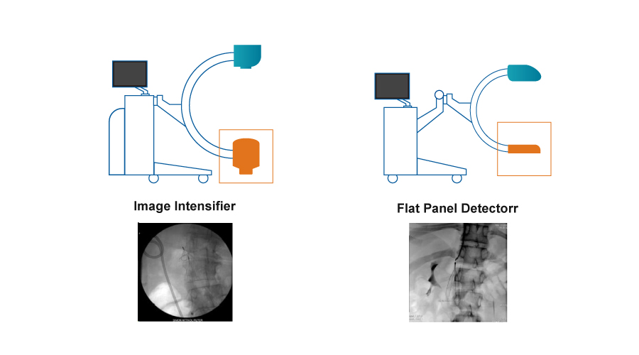 Flat Panel Detector VS Image Intensifier: Which one should be your best choice?cid=12