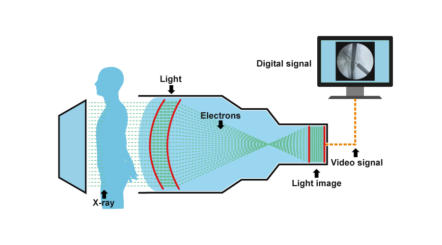 Flat Panel Detector VS Image Intensifier: Which one should be your best choice?cid=12