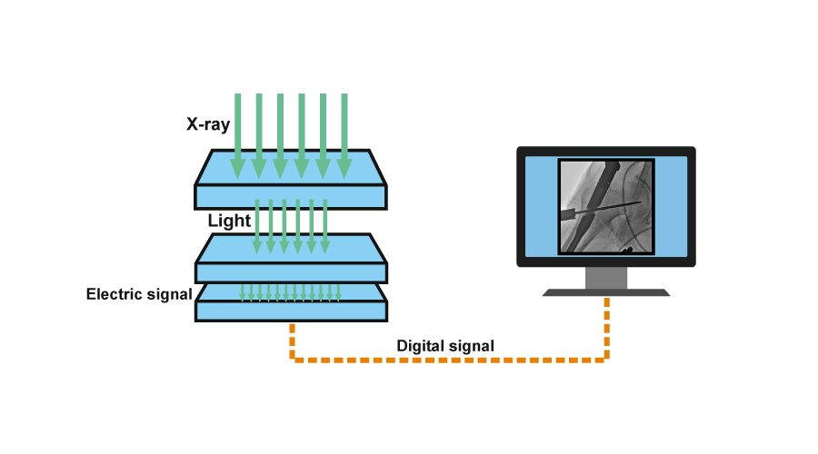 Flat Panel Detector VS Image Intensifier: Which one should be your best choice?cid=12