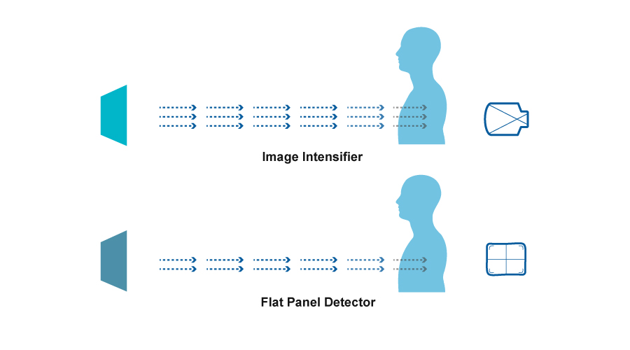 Flat Panel Detector VS Image Intensifier: Which one should be your best choice?cid=12