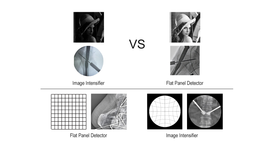 Flat Panel Detector VS Image Intensifier: Which one should be your best choice?cid=12