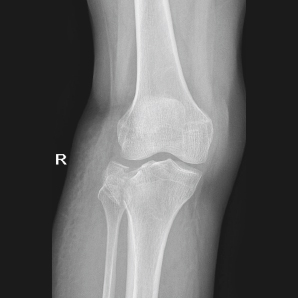 Portable X-ray System