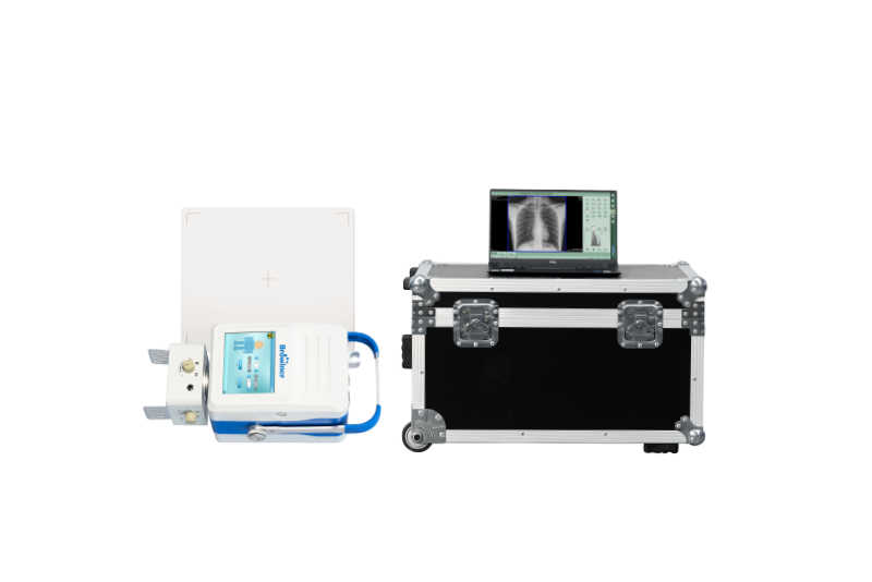 X-ray System | X-ray unit | X-ray machine | light weight | built-in battery